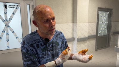 «Люди почали обгорати, як я. Була істерика та паніка». Розповіді пасажирів автобусів, які вижили у Краматорську «Люди почали обгорати, як я. Була істерика та паніка». Розповіді пасажирів автобусів, які вижили у Краматорську