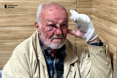 «Люди почали обгорати, як я. Була істерика та паніка». Розповіді пасажирів автобусів, які вижили у Краматорську «Люди почали обгорати, як я. Була істерика та паніка». Розповіді пасажирів автобусів, які вижили у Краматорську