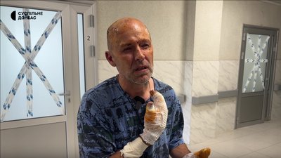 «Люди почали обгорати, як я. Була істерика та паніка». Розповіді пасажирів автобусів, які вижили у Краматорську «Люди почали обгорати, як я. Була істерика та паніка». Розповіді пасажирів автобусів, які вижили у Краматорську