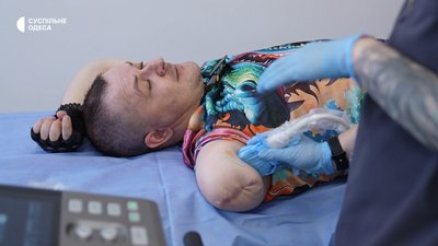«Руки немає, але пальці я відчуваю»: як на Одещині у Центрі лікування болю допомагають пацієнтам «Руки немає, але пальці я відчуваю»: як на Одещині у Центрі лікування болю допомагають пацієнтам