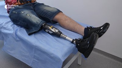«Руки немає, але пальці я відчуваю»: як на Одещині у Центрі лікування болю допомагають пацієнтам «Руки немає, але пальці я відчуваю»: як на Одещині у Центрі лікування болю допомагають пацієнтам