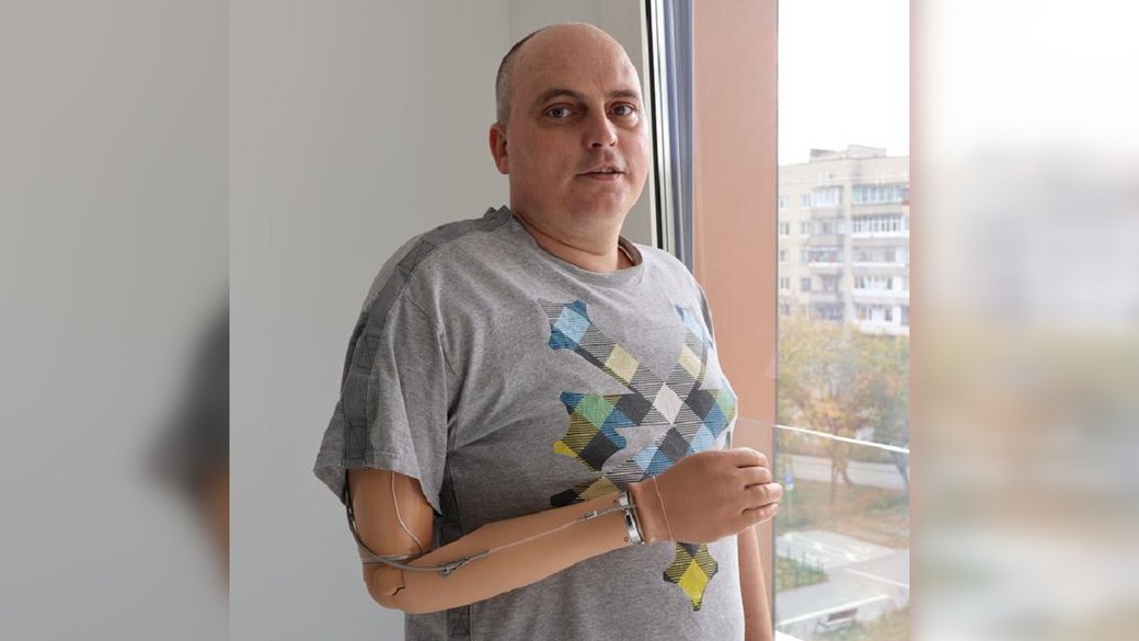 Втратив руку на фронті, витримав 15 операцій і мріє про море з врятованою собакою: шлях воїна зі Львівського центру Unbroken