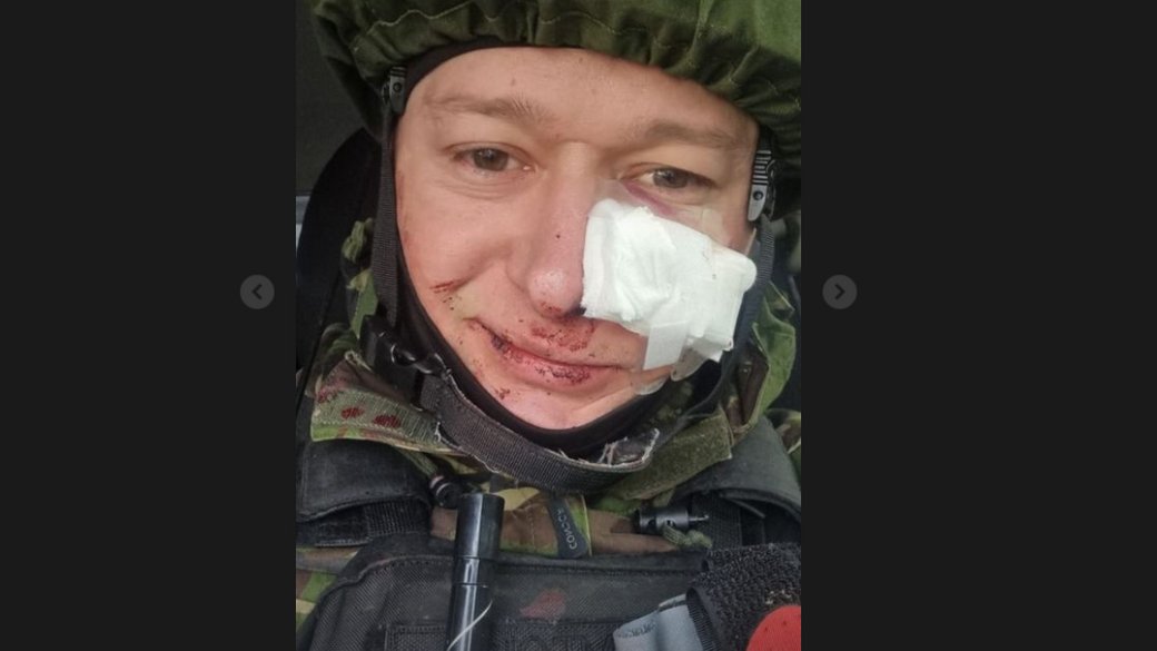 Russia Invades Ukraine Live Updates From Suspilne Suspilne media