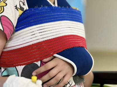 Отримала три переломи, катаючись на гойдалці: львівські лікарі врятували 11-річну дівчинку Отримала три переломи, катаючись на гойдалці: львівські лікарі врятували 11-річну дівчинку