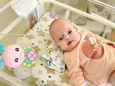 Львівські лікарі виходили дівчинку, яка народилася з вагою 600 грамів Львівські лікарі виходили дівчинку, яка народилася з вагою 600 грамів