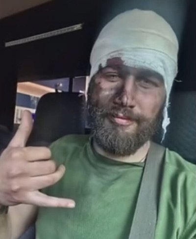 Олександр отримав поранення під час виконання бойового завдання Олександр отримав поранення під час виконання бойового завдання