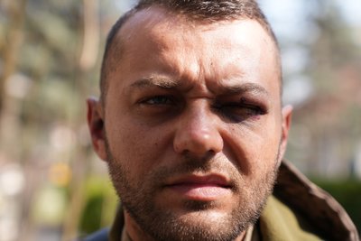 Олександр Лисий, побиття, ветеран, Франкіщина Олександр Лисий, побиття, ветеран, Франкіщина