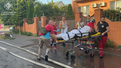 В Одесі через пожежу госпіталізували чоловіка та дівчинку В Одесі через пожежу госпіталізували чоловіка та дівчинку