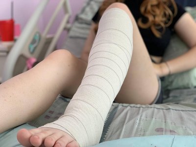 Було важко ходити: у Львові лікарі видалили 17-річній дівчині з ноги три пухлини Було важко ходити: у Львові лікарі видалили 17-річній дівчині з ноги три пухлини