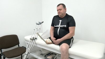 На Черкащині лікарі із США безоплатно виготовляють протези для цивільних та військових На Черкащині лікарі із США безоплатно виготовляють протези для цивільних та військових