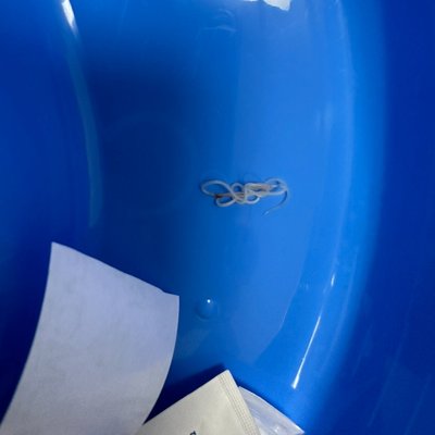 Львівські хірурги видалили гельмінта з-під шкіри 5-річного хлопчика Львівські хірурги видалили гельмінта з-під шкіри 5-річного хлопчика