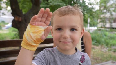 У дитсадку Дніпра хлопчик впав на скло, коли йшов до укриття: що про інцидент розповіла мама та працівники закладу У дитсадку Дніпра хлопчик впав на скло, коли йшов до укриття: що про інцидент розповіла мама та працівники закладу