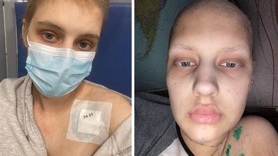 "Це був незвичний кашель": історія черкащанки, яка бореться з онкозахворюванням "Це був незвичний кашель": історія черкащанки, яка бореться з онкозахворюванням