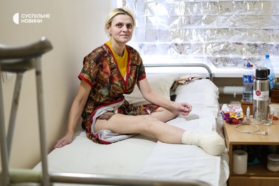 Староста села Садове на Херсонщині Олена Семеніхіна в лікарні у Херсоні. Жінка наступила на протипіхотну міну-пелюстку Староста села Садове на Херсонщині Олена Семеніхіна в лікарні у Херсоні. Жінка наступила на протипіхотну міну-пелюстку