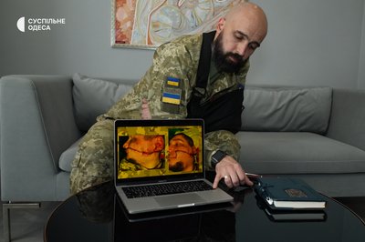 Закрив собою пораненого побратима: історія пластичного хірурга з Одеси