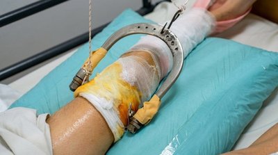 Бійка у школі на Кіровоградщині: 14-річний хлопець у лікарні з переломом, поліція відкрила провадження Бійка у школі на Кіровоградщині: 14-річний хлопець у лікарні з переломом, поліція відкрила провадження