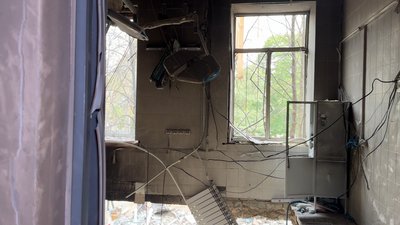 "Це було питання часу". Ортопед з травмпункту розповів, як витягували людей з-під завалів в лікарні св. Пантелеймона "Це було питання часу". Ортопед з травмпункту розповів, як витягували людей з-під завалів в лікарні св. Пантелеймона