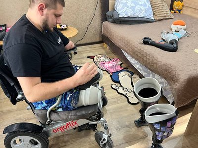 Життя з новим тілом: історія черкаського ветерана з трьома ампутаціями Життя з новим тілом: історія черкаського ветерана з трьома ампутаціями