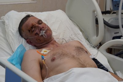 На Дніпропетровщині лікують подружжя з Костянтинівки, яке врятували з-під завалів На Дніпропетровщині лікують подружжя з Костянтинівки, яке врятували з-під завалів