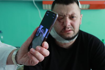 30 операцій військовим за чотири дні. У Франківську канадські та американські хірурги завершили місію "Face the Future" 30 операцій військовим за чотири дні. У Франківську канадські та американські хірурги завершили місію "Face the Future"