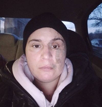 "На шляху до моєї великої краси": в Одесі безкоштовно видаляють травматичні татуювання "На шляху до моєї великої краси": в Одесі безкоштовно видаляють травматичні татуювання