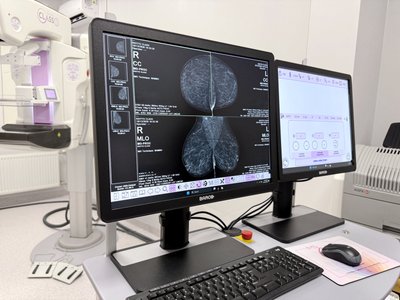 В Одесі встановили новий 3D-мамограф: де можна безкоштовно пройти мамографію В Одесі встановили новий 3D-мамограф: де можна безкоштовно пройти мамографію