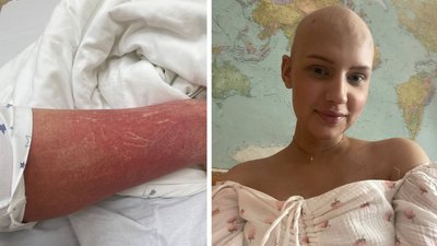 "Земля пішла з-під ніг": історія черкащанки, яка бореться з раком "Земля пішла з-під ніг": історія черкащанки, яка бореться з раком