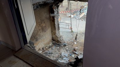 "Це було питання часу". Ортопед з травмпункту розповів, як витягували людей з-під завалів в лікарні св. Пантелеймона "Це було питання часу". Ортопед з травмпункту розповів, як витягували людей з-під завалів в лікарні св. Пантелеймона