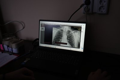 Лікаря Святого Пантелеймона отримала нове обладнання