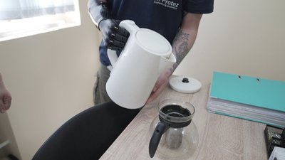 "Виготовляється під кожного пацієнта індивідуально": як у Вінниці захисникам встановлюють біонічні протези "Виготовляється під кожного пацієнта індивідуально": як у Вінниці захисникам встановлюють біонічні протези