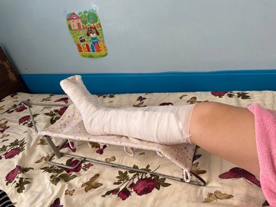 «Не могла стати на ногу»: як почувається Поліна Андрусенко, на яку впав у Полтаві світлофор «Не могла стати на ногу»: як почувається Поліна Андрусенко, на яку впав у Полтаві світлофор