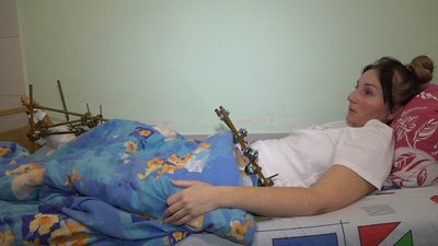 "Він не зупинився": жителька Житомирщини пережила 8 операцій після ДТП і заявляє про бездіяльність слідства "Він не зупинився": жителька Житомирщини пережила 8 операцій після ДТП і заявляє про бездіяльність слідства