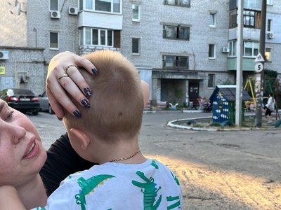Пробита голова, садна та забій грудної клітини. У Дніпрі дворічний хлопчик провалився в триметровий люк у дворі Пробита голова, садна та забій грудної клітини. У Дніпрі дворічний хлопчик провалився в триметровий люк у дворі