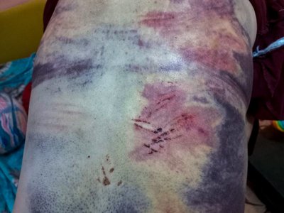 вчителька переселенка з Луганщини Галина Глобчаста староста Макіївка Греківка окупація армія РФ катування Новояворівськ Львівська область 10 жовтня 2024 рік вчителька переселенка з Луганщини Галина Глобчаста староста Макіївка Греківка окупація армія РФ катування Новояворівськ Львівська область 10 жовтня 2024 рік