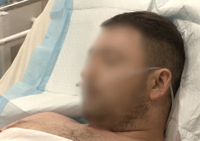 "Немає пальців, але життя врятоване". На Дніпропетровщині лікують двох військових із Донецького напрямку "Немає пальців, але життя врятоване". На Дніпропетровщині лікують двох військових із Донецького напрямку