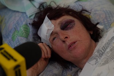 Що відомо про стан поранених після удару по Сумах Що відомо про стан поранених після удару по Сумах
