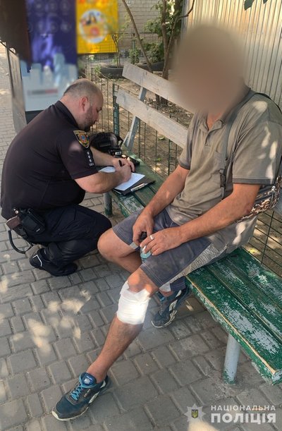Дев'ятсот тридцять перший день війни. Хроніка подій в Одеській області Дев'ятсот тридцять перший день війни. Хроніка подій в Одеській області