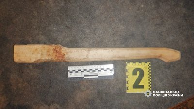На Одещині 5-річного хлопчика госпіталізували після побиття: матері повідомили про підозру На Одещині 5-річного хлопчика госпіталізували після побиття: матері повідомили про підозру