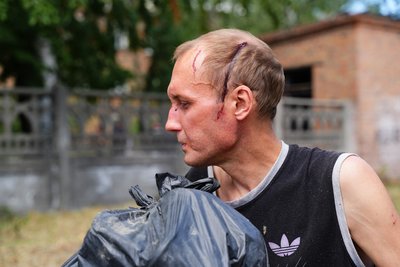поранений Олександр Бауков поранений Олександр Бауков