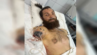 Навчився грати і малювати ногами: реабілітація ветерана з Миколаєва Навчився грати і малювати ногами: реабілітація ветерана з Миколаєва