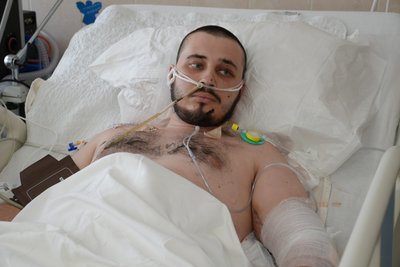 Чекав на евакуацію майже добу та втратив обидві ноги: на Дніпропетровщині лікують 27-річного оператора бомберів Ігоря Чекав на евакуацію майже добу та втратив обидві ноги: на Дніпропетровщині лікують 27-річного оператора бомберів Ігоря