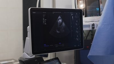Трансплантація серця і нирок: у Вінниці лікарі за добу врятували три життя Трансплантація серця і нирок: у Вінниці лікарі за добу врятували три життя
