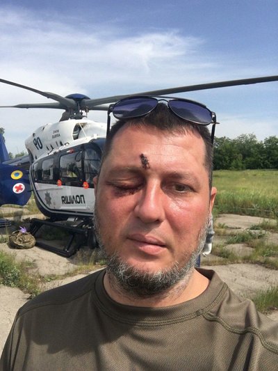 Максим Кудасов після поранення Максим Кудасов після поранення