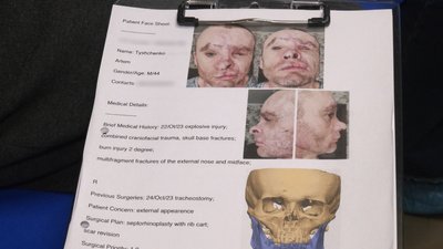 Артем Тищенко, поранення Артем Тищенко, поранення