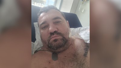 Бійця везли до моргу без руки та пульсу, а він вижив: історія ветерана Руслана Іванова з Чернігова Бійця везли до моргу без руки та пульсу, а він вижив: історія ветерана Руслана Іванова з Чернігова