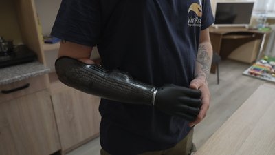 "Виготовляється під кожного пацієнта індивідуально": як у Вінниці захисникам встановлюють біонічні протези "Виготовляється під кожного пацієнта індивідуально": як у Вінниці захисникам встановлюють біонічні протези
