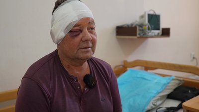 20 поранених за півтори години. Що розповіли херсонці, які потрапили під удари російських БпЛА 20 поранених за півтори години. Що розповіли херсонці, які потрапили під удари російських БпЛА