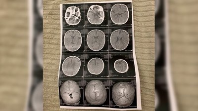 У Польщі очікує на перетин кордону хмельничанин, немовля якого потрапило у лікарню У Польщі очікує на перетин кордону хмельничанин, немовля якого потрапило у лікарню