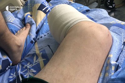 Військовий з протезом Військовий з протезом