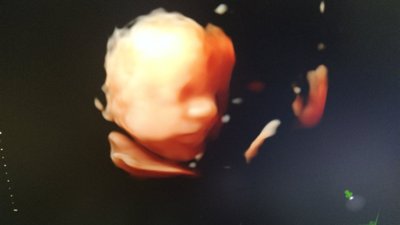 У Полтавському обласному перинатальному центрі загинуло одноденне немовля: у чому причина У Полтавському обласному перинатальному центрі загинуло одноденне немовля: у чому причина